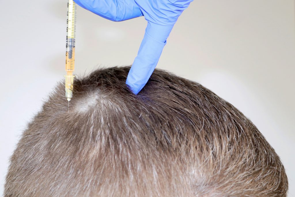 hair transplant cost turkey